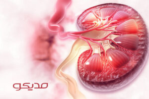 فشار خون بالا و بیماری کلیوی