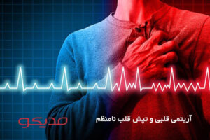 آریتمی قلبی