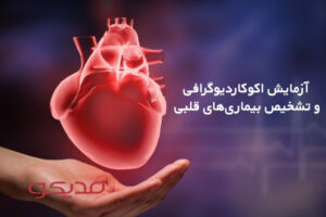 آزمایش اکوکاردیوگرافی و تشخیص بیماری‌های قلبی